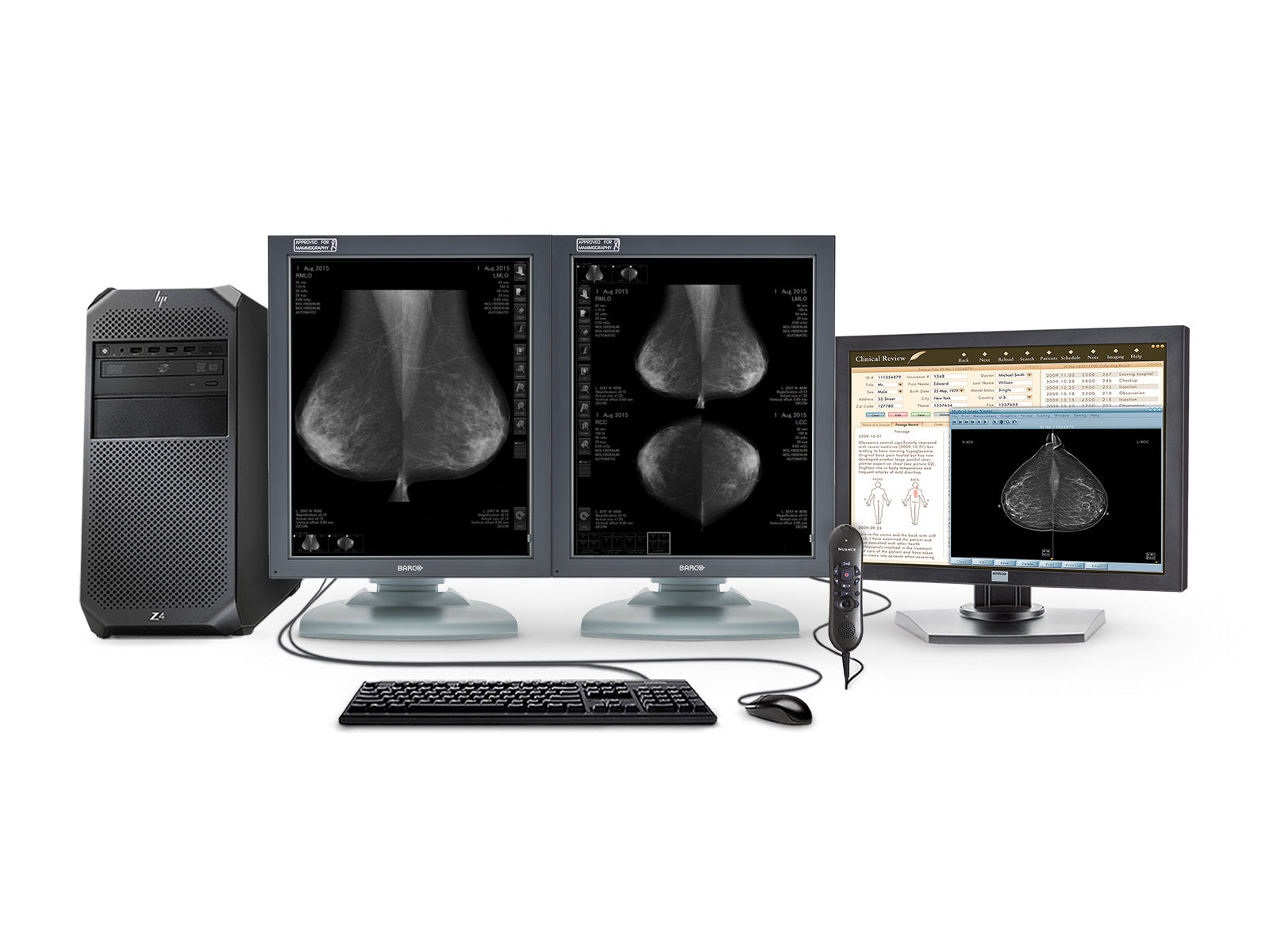 Complete Mammography Reading Station | HP Workstation