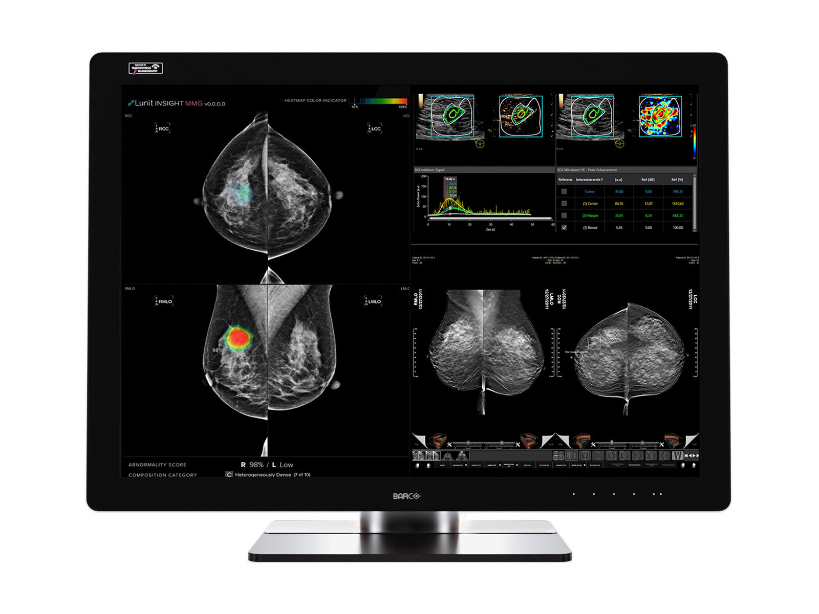 Barco Coronis UNITI MDMC-12133 12MP 33" Tomo Color LED Mammo 3D DBT PACS Display Monitors.com 