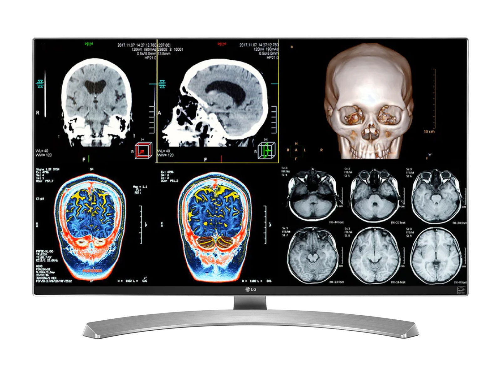 LG 27" 8MP Color Clinical Review Medical Display Monitor (27M-W) Monitors.com 