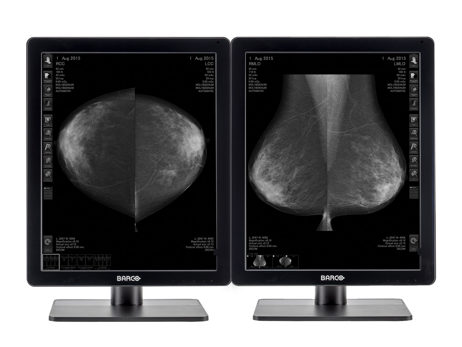 Complete Mammography Reading Station | HP Workstation