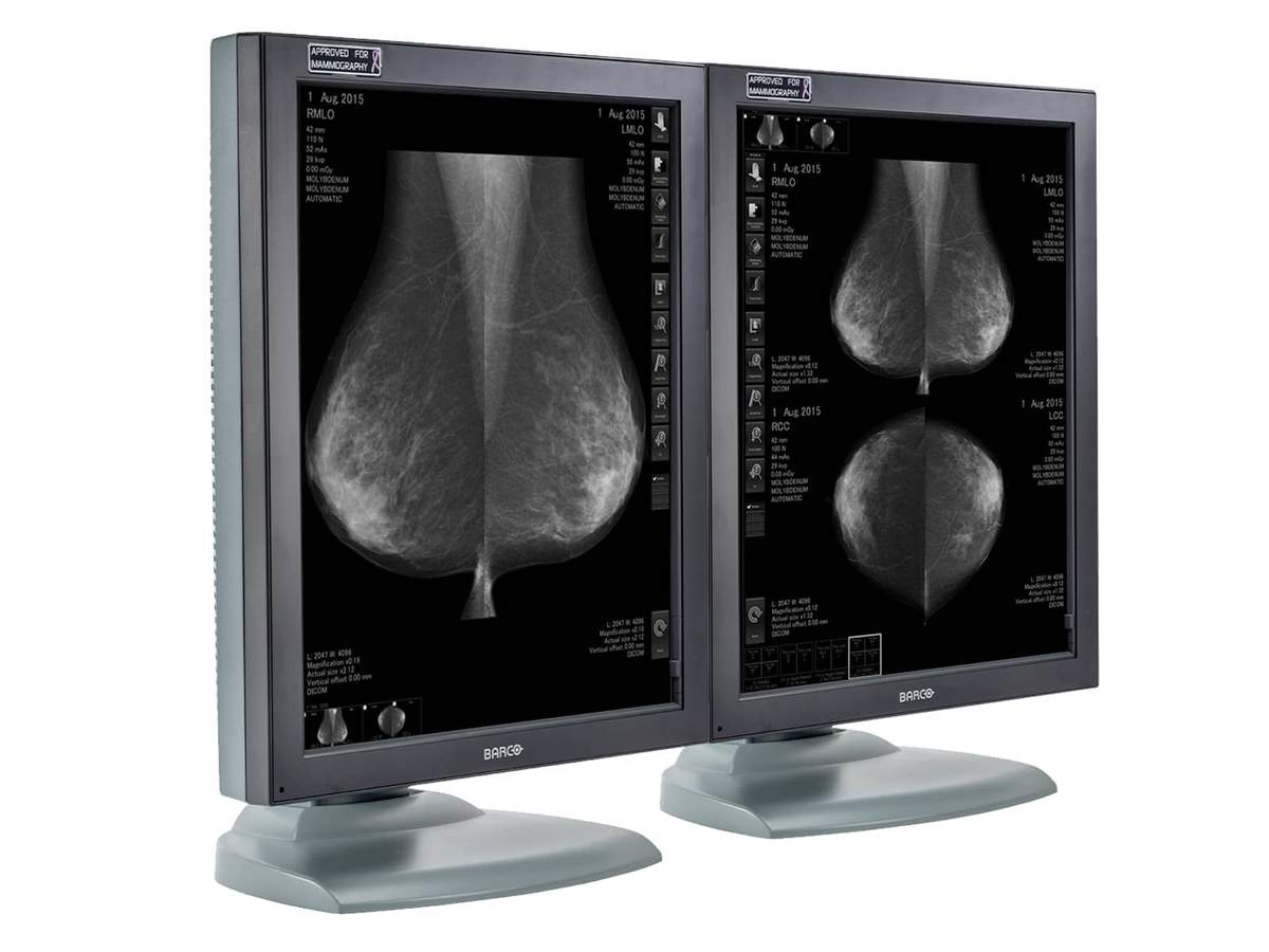 Complete Mammography Reading Station | HP Workstation