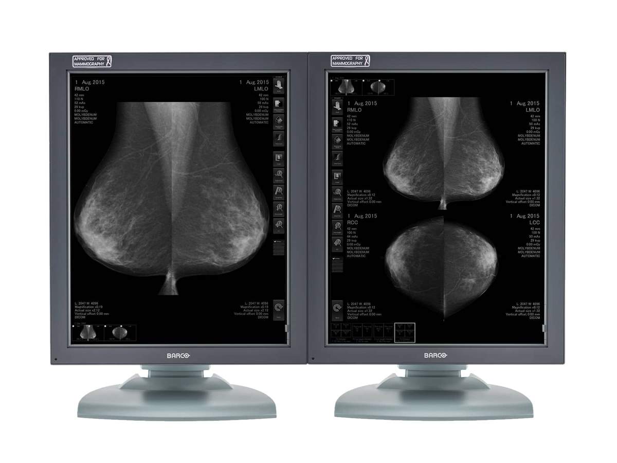 Complete Mammography Reading Station | HP Workstation